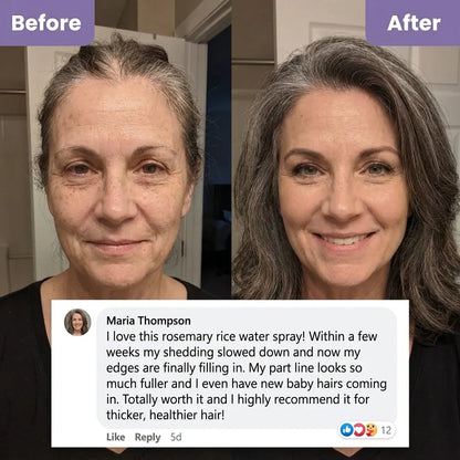 Rosemary + Rice Water Hair Growth Spray