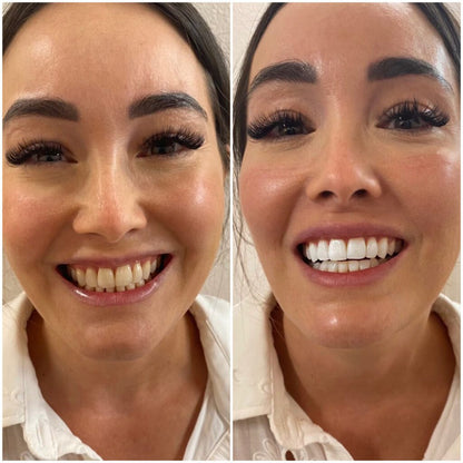 Nicotinamide Whitening Toothpaste