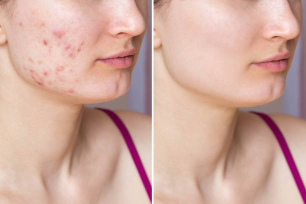 Tallow Moisturizer